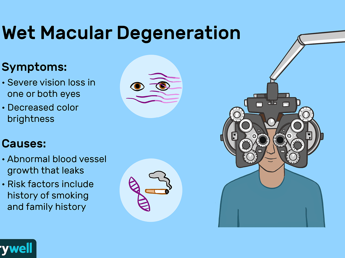 Wet Macular Degeneration Arogya Finance All Blog Posts Medical